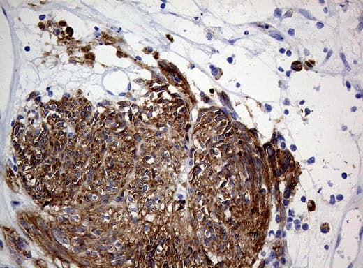ANO1 / DOG1 / TMEM16A Antibody (aa1-333, clone OTI1C8, Carrier-free)