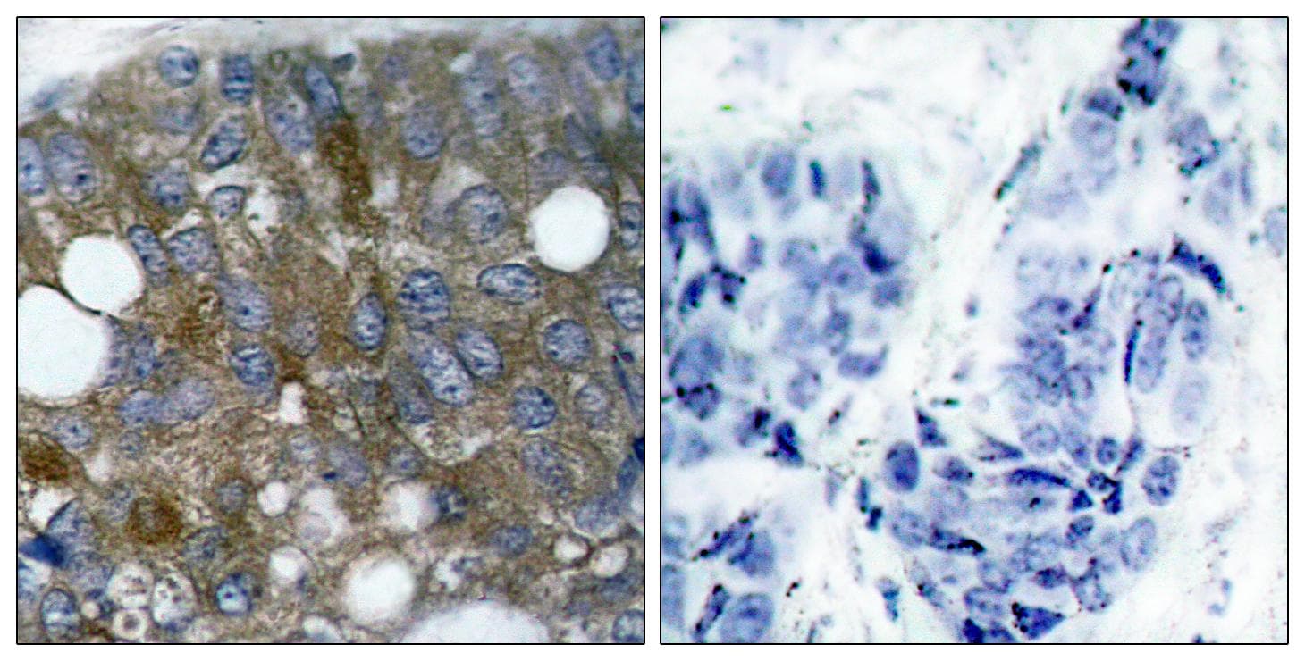 HSPB1 / HSP27 Antibody (phospho-Ser15)