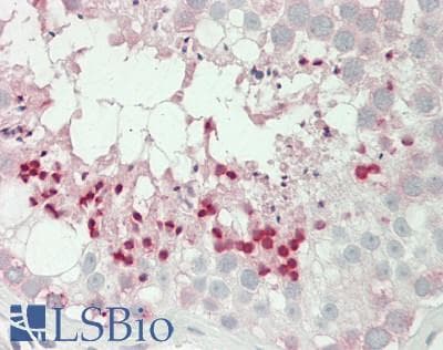 IHC-plus™ ADCY1 / Adenylate Cyclase 1 Antibody (aa230-280)