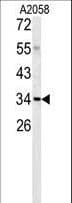 C1QTNF1 / CTRP1 Antibody (aa32-61)