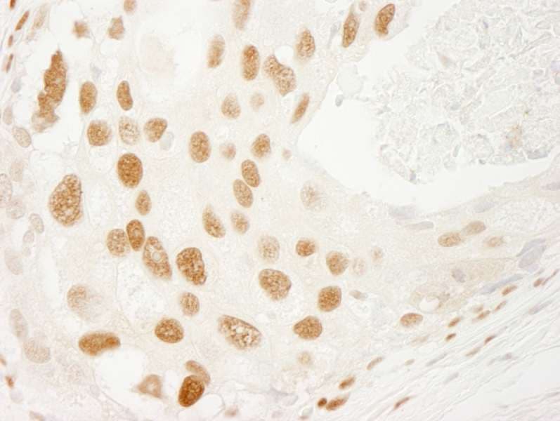 PML Antibody (aa375-425)