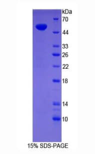 Human SYNPO / Synaptopodin Protein (Recombinant His-GST)