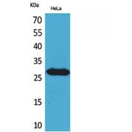 Polyclonal Rabbit anti-Human SNRPN Antibody (21-70 aa, Internal, WB)