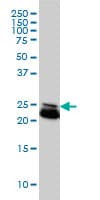 RAB21 Antibody (clone 1F6)
