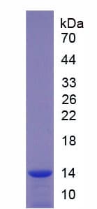 Human HPSE / Heparanase Protein (Recombinant His)
