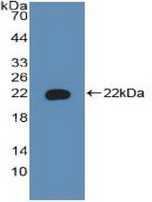 BAD Antibody (aa1-168, APC)