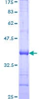 Human KLRC3 / NKG2E Protein (Recombinant GST, N-terminus)