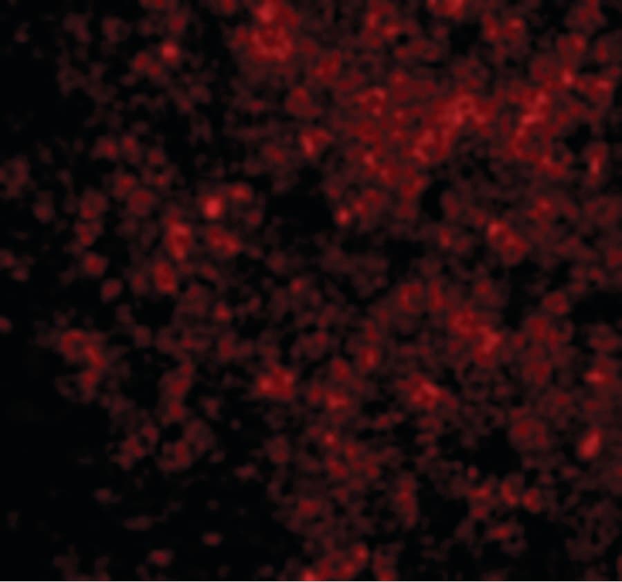 BAD Antibody