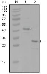 Monoclonal Mouse anti-Human ER Alpha / Estrogen Receptor Antibody (clone 8H9A10, WB)