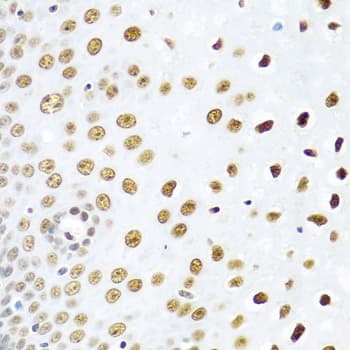 SSB / La Antibody