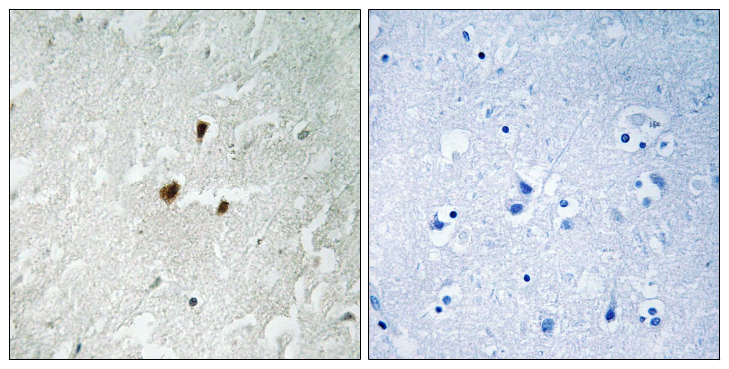 TIF-IA / RRN3 Antibody (phospho-Ser649)