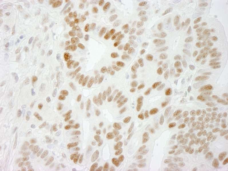 Polyclonal Rabbit anti-Human SMEK1 Antibody (aa770-C-term, IHC, IF)