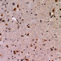 Polyclonal Rabbit anti-Human TRPC3 Antibody (IHC, WB)
