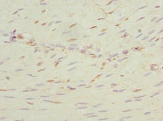 NEK3 Antibody