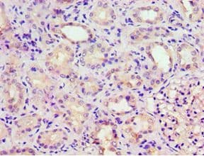 Polyclonal Rabbit anti-Human GRK6 Antibody (aa1-170, IHC, WB)