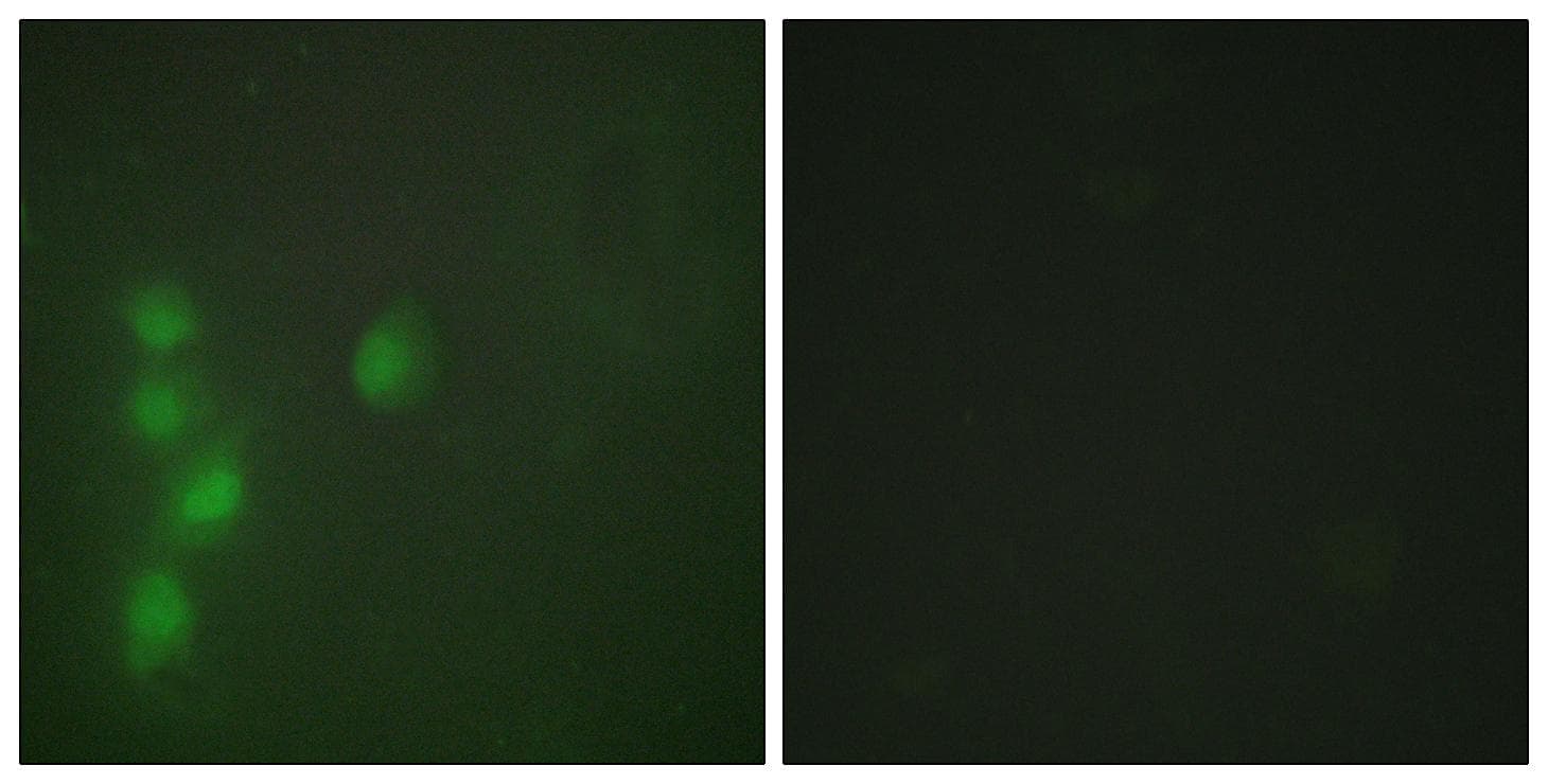 ZNF174 Antibody
