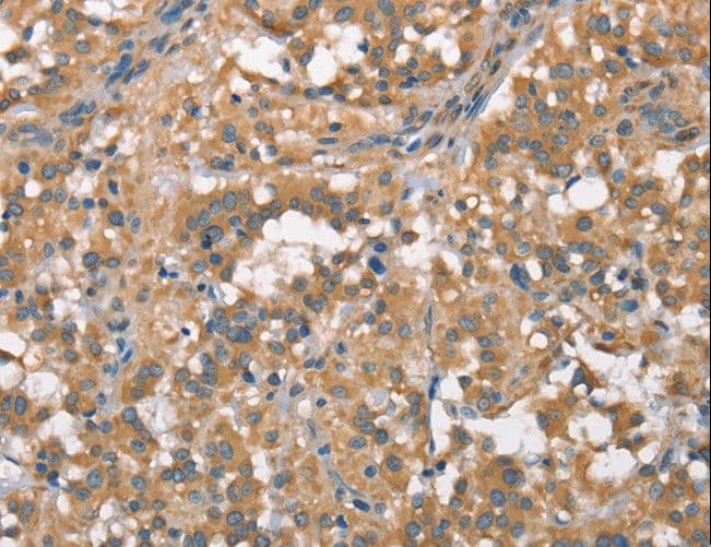 PLEKHO1 / CKIP-1 Antibody