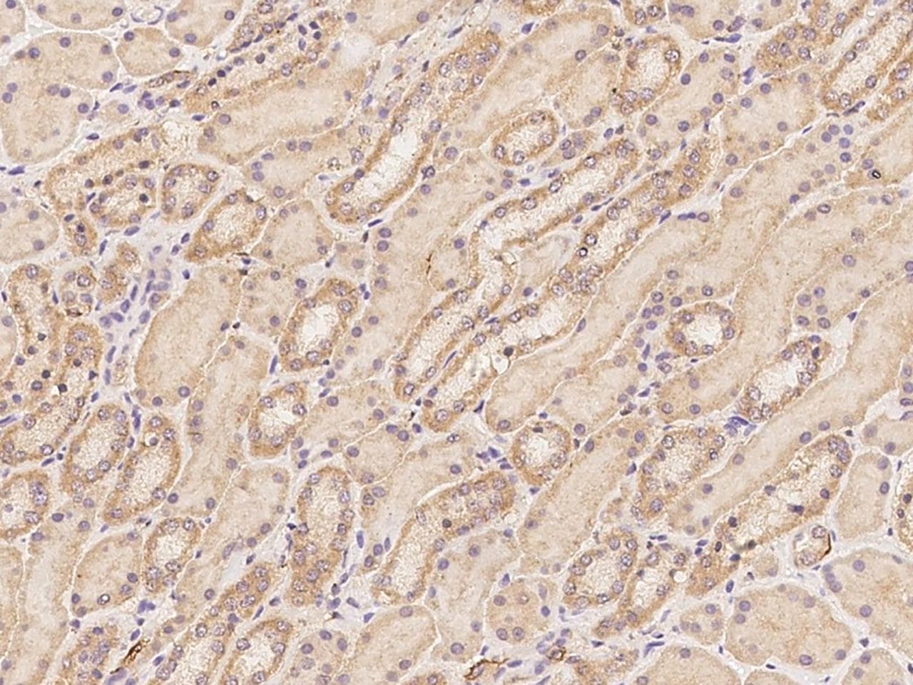 Polyclonal Rabbit anti-Human LETMD1 / HCCR1 Antibody (IHC)