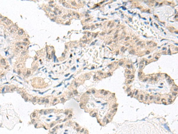 GFI1B Antibody