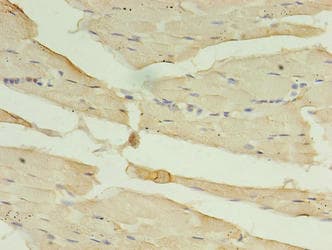 Polyclonal Rabbit anti-Human CA-VB / CA5B Antibody (IHC, WB)