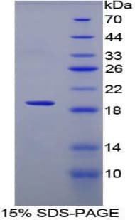 Mouse IL12RB2 Protein (Recombinant His)