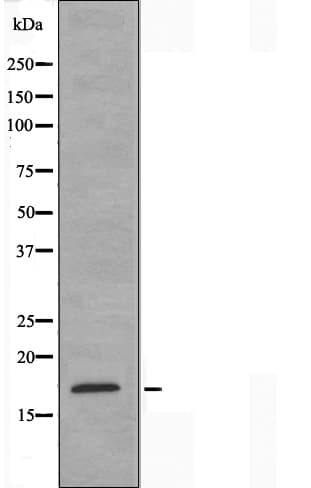 Polyclonal Rabbit anti-Human SSBP1 / mtSSB Antibody (IHC, IF, WB)