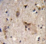 ALDH18A1 Antibody (aa176-205)
