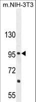 CCDC39 Antibody (aa770-798)
