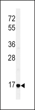 EREG / Epiregulin Antibody (aa137-165)
