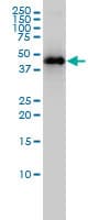 KRT33B / Keratin 33B / KRTHA3B Antibody (clone 4A6-A7)