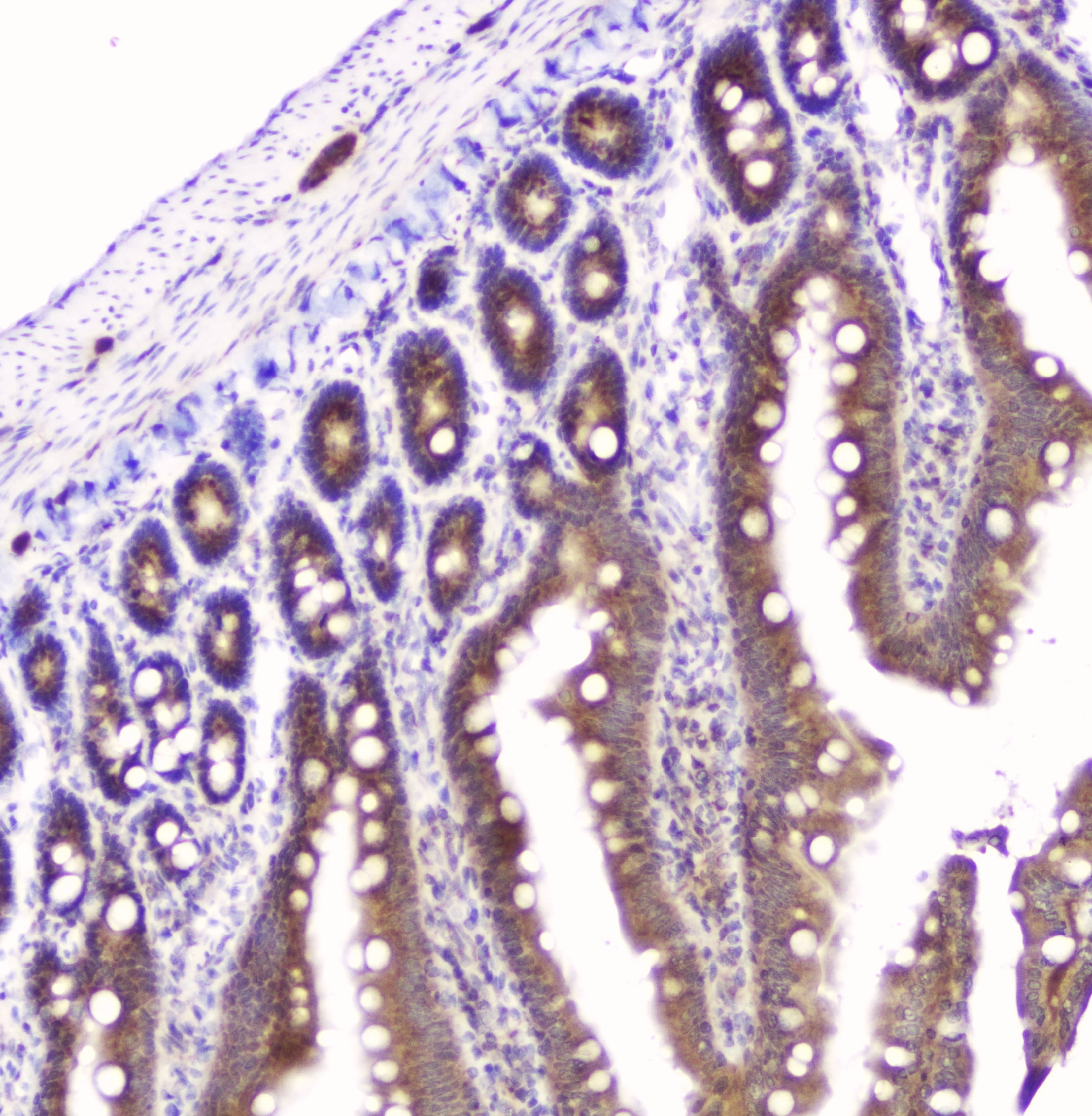 Polyclonal Rabbit anti-Human GOLPH3 Antibody (IHC, WB)