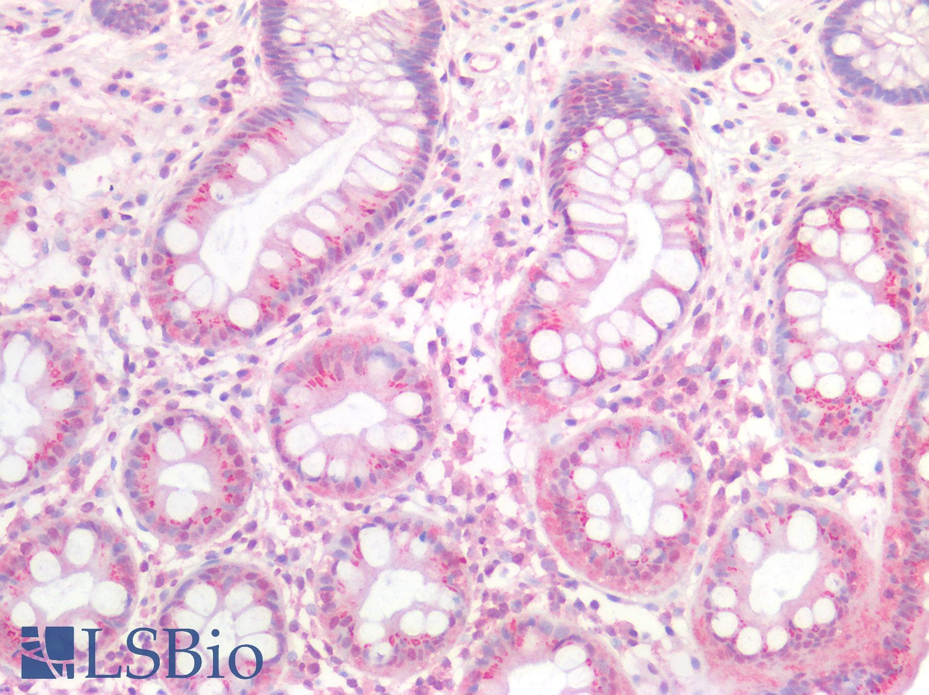 IHC-plus™ CHRNA7 Antibody