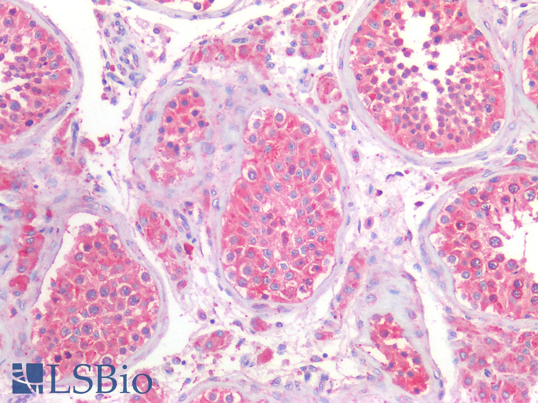 IHC-plus™ HSPA5 / GRP78 / BiP Antibody