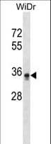 PIGL Antibody (aa8-37)