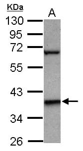LHX5 Antibody (Internal)