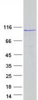 Human EXOC6B Protein (Recombinant Myc-DDK (Flag))
