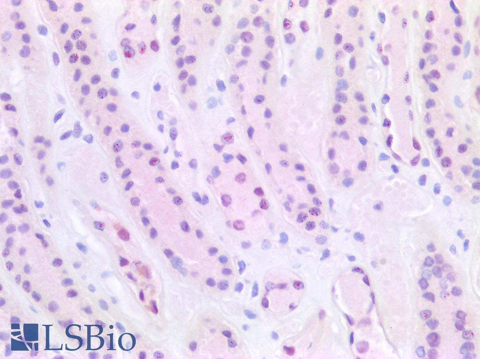 PathPlus™ HNF1B / HNF1 Beta Antibody