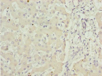 Polyclonal Rabbit anti-Human ADPGK Antibody (IHC, WB)