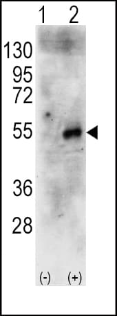 RPS6KB2 / S6K2 Antibody (aa243-272)