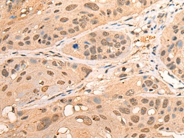 BPGM Antibody