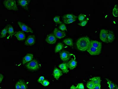 RB1CC1 / CC1 Antibody