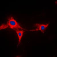 CYP2A13 Antibody (Internal)