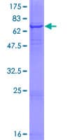 Human AADAC Protein (Recombinant GST)