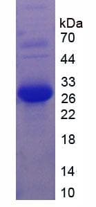 Mouse LAMA2 / Merosin Protein (Recombinant 6His, N-terminus)