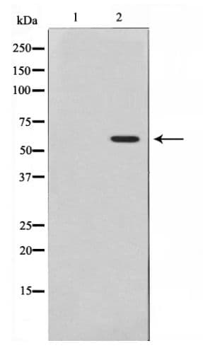 Polyclonal Rabbit anti-Human AKT1 Antibody (phospho-Thr308, IHC, WB)