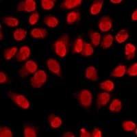 Polyclonal Rabbit anti-Human HIST3H3 Antibody (IHC, IF, WB)