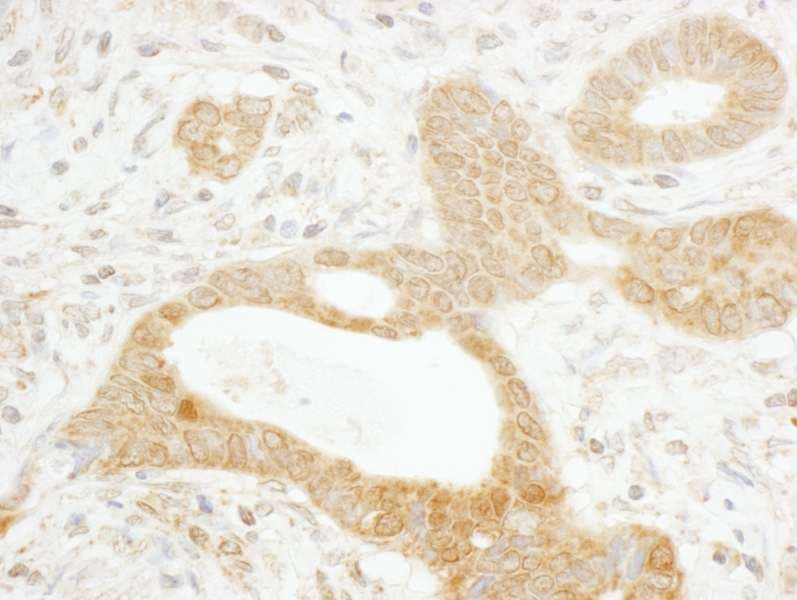 TNKS / Tankyrase Antibody (aa1277-1327)