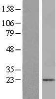 ITGB1BP1 / ICAP1 Protein (Over-Expression Lysate Myc-DDK (Flag))