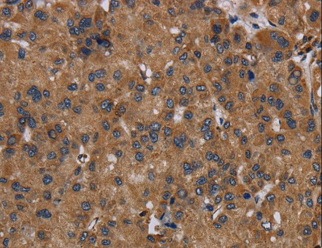 NDUFS8 Antibody