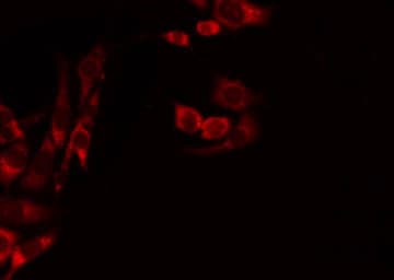 Polyclonal Rabbit anti-Human MRPL39 Antibody (IHC, IF, WB)